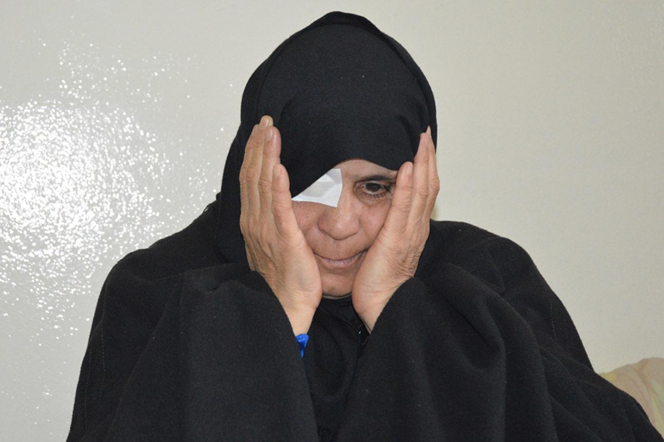Suriyeli kadın ikinci gözünü de kaybetmek istemiyor Suriyeli kadın ikinci gözünü de kaybetmek istemiyor